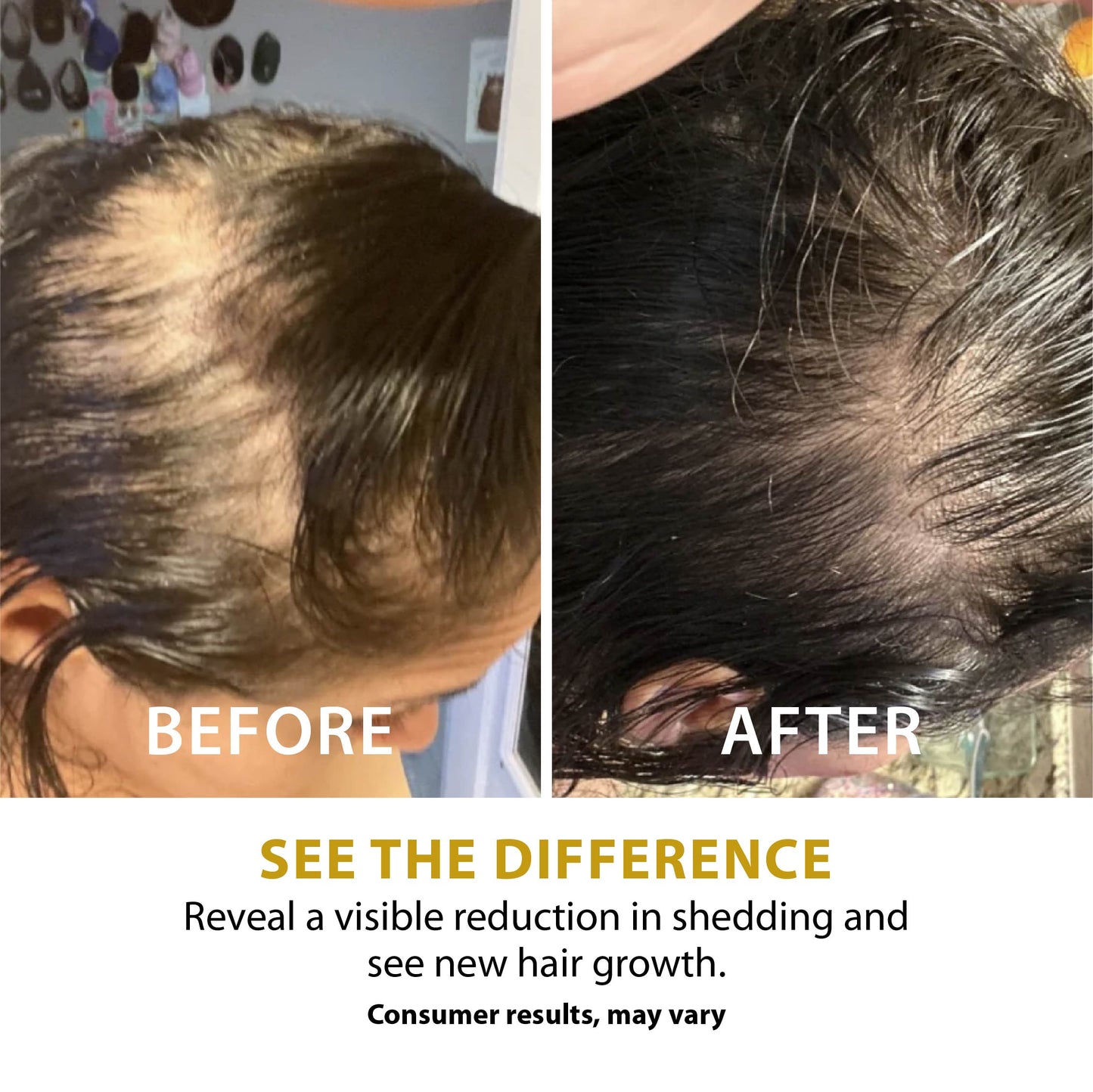 Folix22 Hair Growth Formula