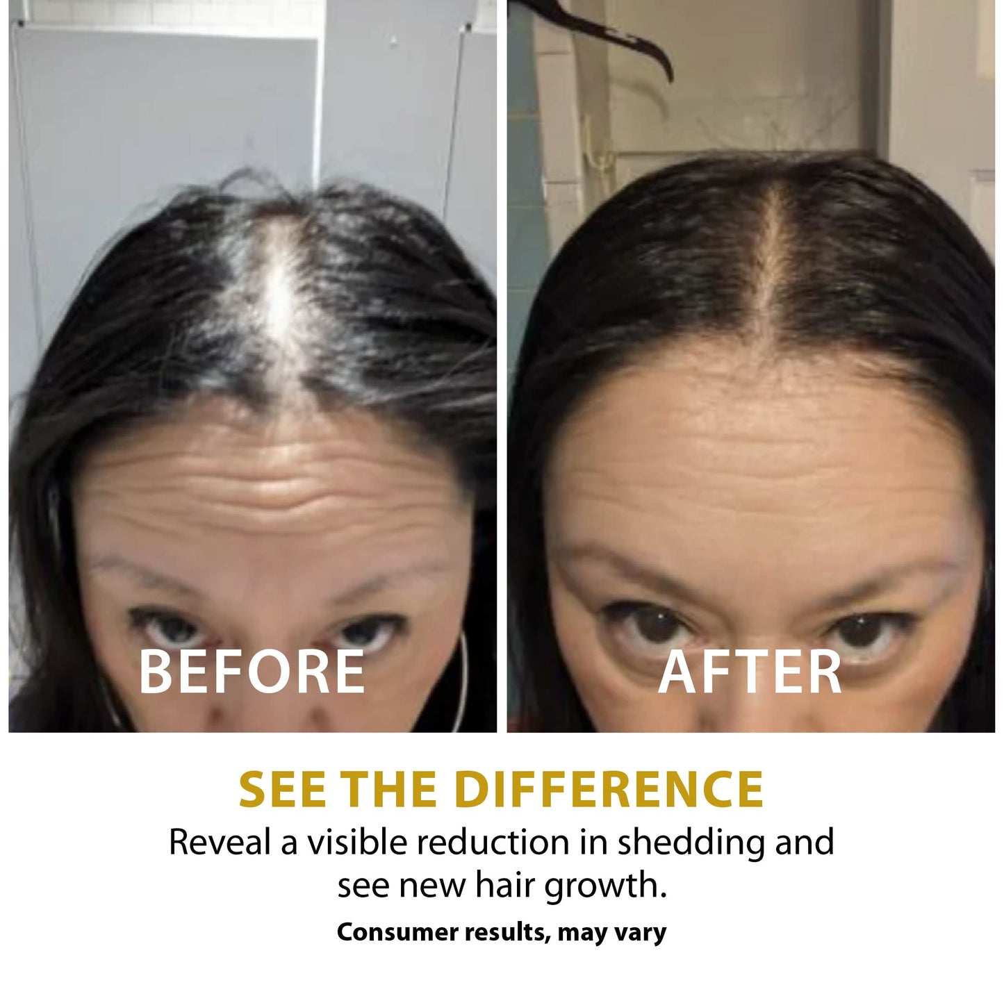 Folix22 Hair Growth Formula